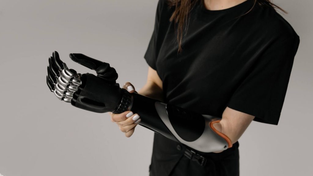 A woman with a prosthetic arm.